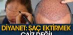 Diyanet’ten ‘saç ekimi’ fetvası